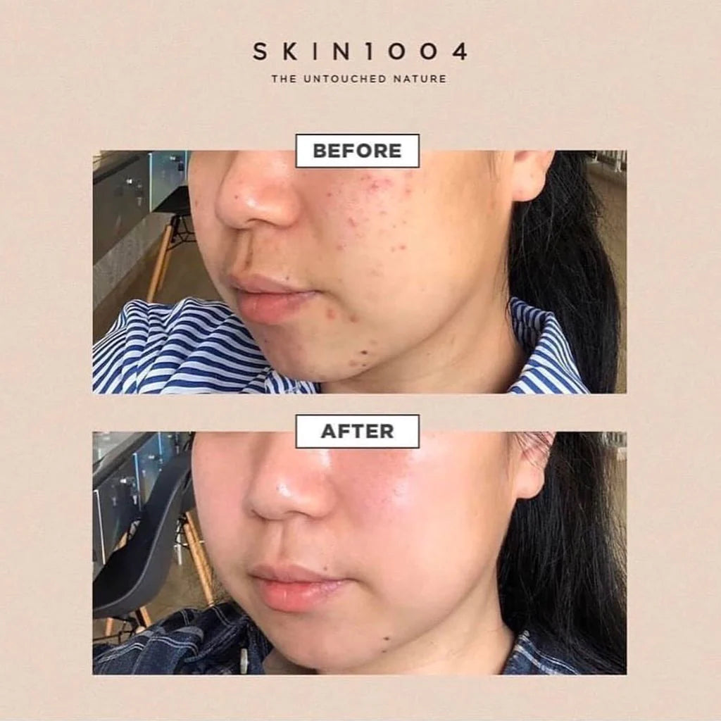 Madagascar Centella skin1004 30ml Amp