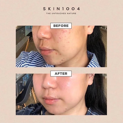 Madagascar Centella skin1004 30ml Amp